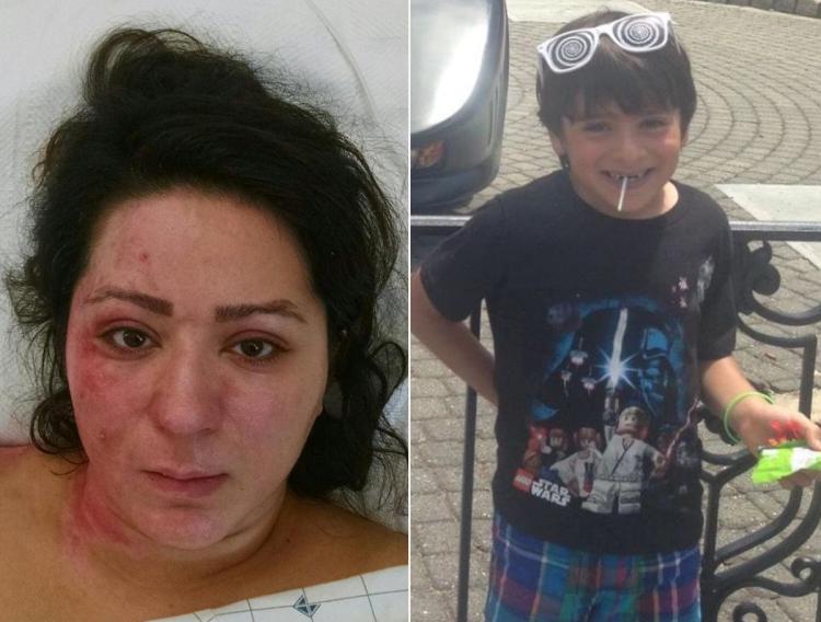 A FAMILY NO MORE — Narges Shafeirad (left) was photographed by the police in the hospital where she was taken after she burned herself while trying to incinerate the body of her five-year-old son, Daniel Dana (right), whom she had earlier killed by poisoning.