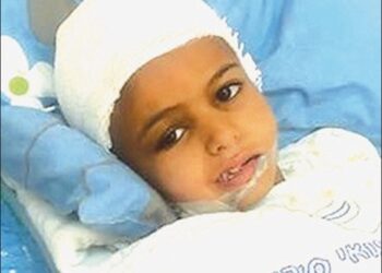 Bedouin Girl Hit in Iran Attack Recovering