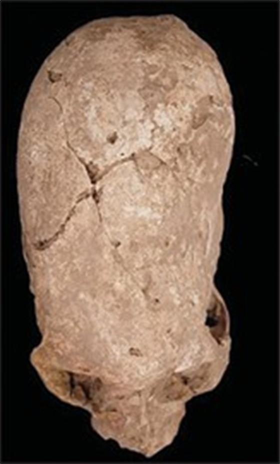 6,000-Year-Old Conical Skull Found In Abadan Dig